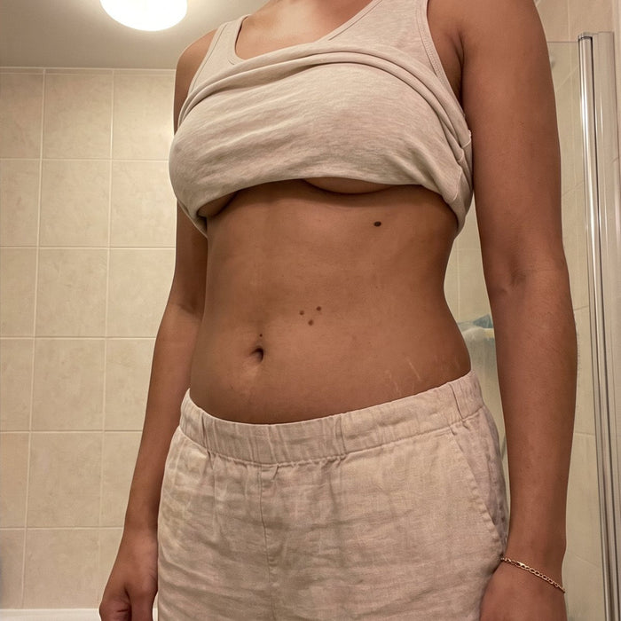 After: Woke up bloated. Went to bed the same.