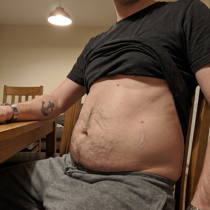 Before: Two hours after the same meal